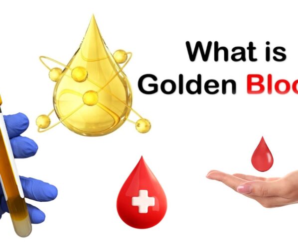 Do you know about the golden blood type?