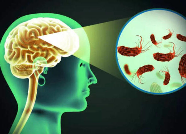 Brain-eating amoeba' in Kerala.. Should lockdown be imposed..?